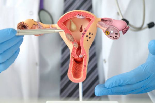 Gynaecological Disorders Treatment in Kanpur